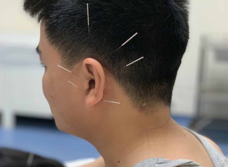 Can Acupuncture help Anxiety and Depression