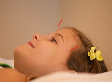 Treating Children with Acupuncture
