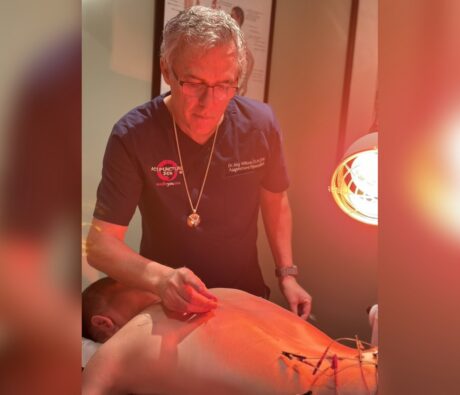 Dr. Tony Willcox placing needles along a patient's back, with electro-acupuncture on the lower back under an infrared heat lamp, during acupuncture for Tarlov cyst pain