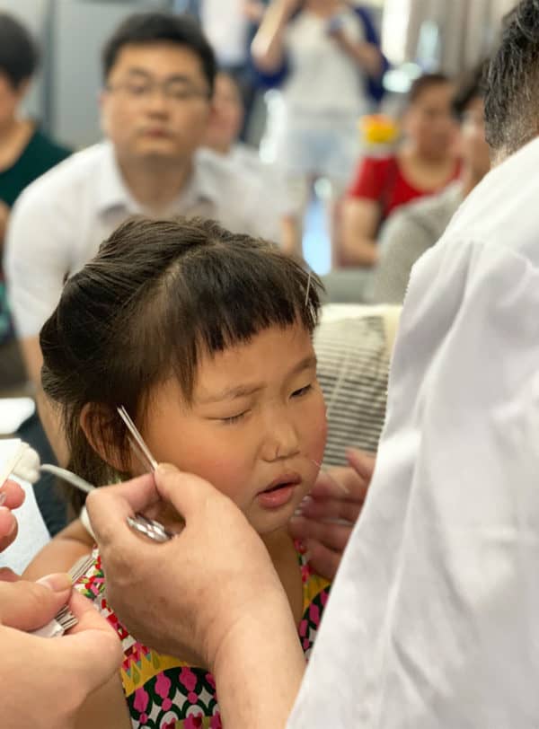 Acupuncture for mumps in children