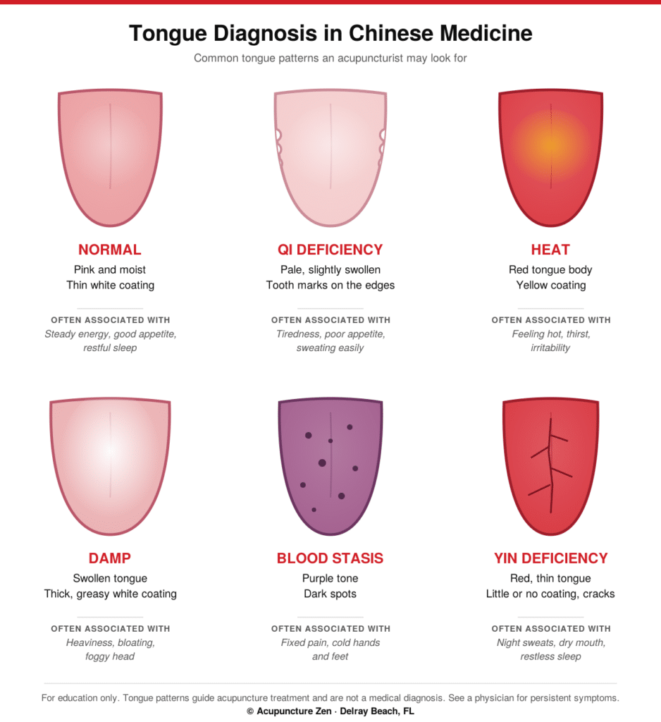 Tongue diagnosis chart showing normal, Qi deficiency, heat, damp, blood stasis, and Yin deficiency tongue patterns with associated signs