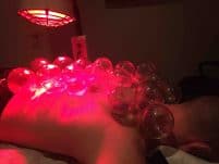 Cupping therapy under infrared light