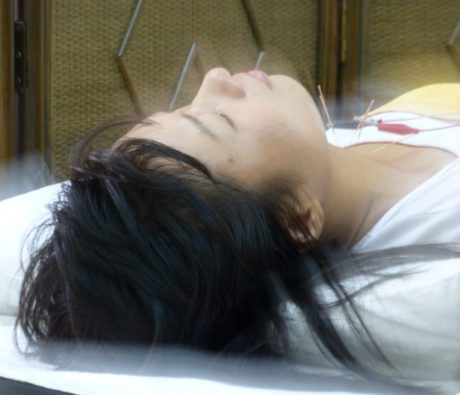 Acupuncture and Qi