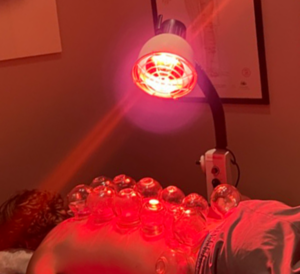 Patient receiving cupping therapy with infrared heat lamp on back at Acupuncture Zen in Delray Beach, Florida — traditional Chinese medicine treatment for pain relief and muscle recovery