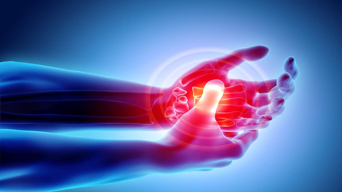 3D illustration of Palm painful - skeleton x-ray, medical concept.