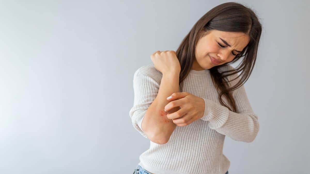 Woman scratching a red, irritated patch on her arm, representing dermatitis