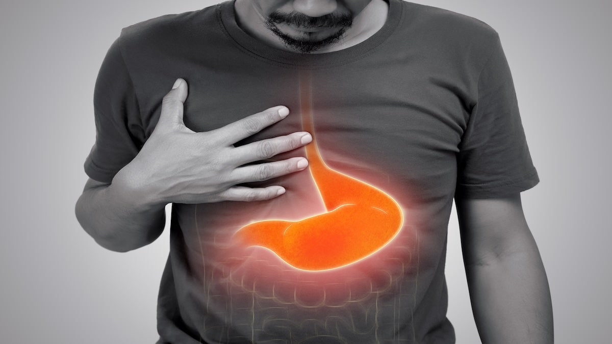 Man holding his stomach with gastritis inflammation illustrated — Acupuncture Zen in Delray Beach