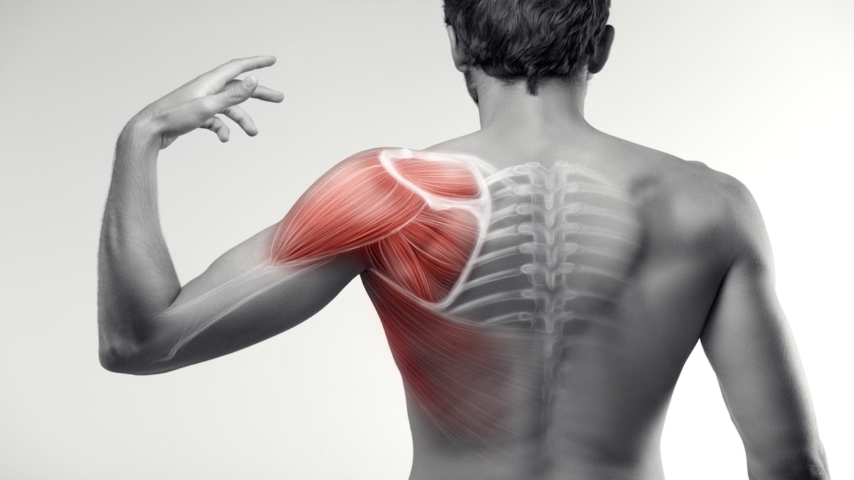 Man's back and shoulder with the shoulder muscles and joint highlighted in red over an x-ray view, shoulder pain acupuncture in Delray Beach