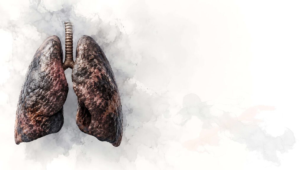 Illustration of smoke-damaged lungs showing the health effects of smoking