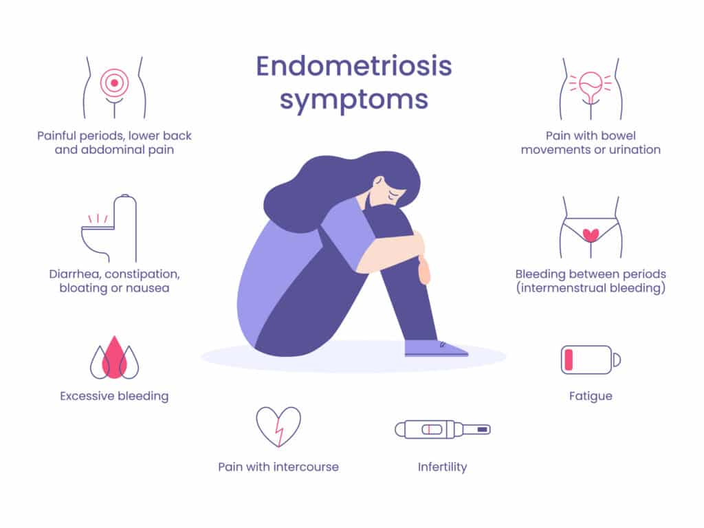 Infographic of common endometriosis symptoms including painful periods, pelvic and lower-back pain, bloating, fatigue, and pain with intercourse.