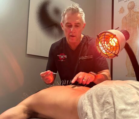 Acupuncture for Sciatica: What the Research Shows